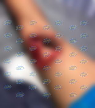 Embravecido perro casi arranca pierna a niño