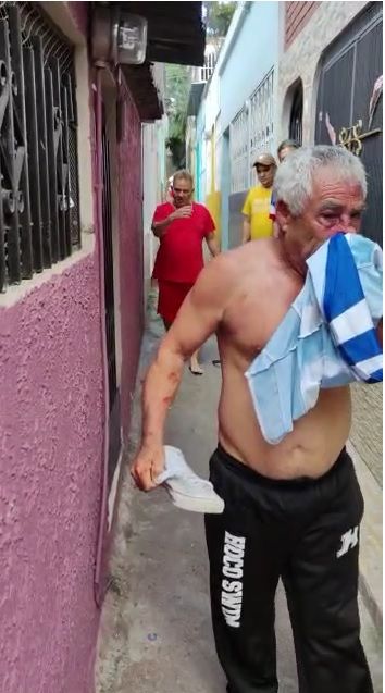 Vecinos linchan a un hombre de la tercera edad por el ruido de sus perros