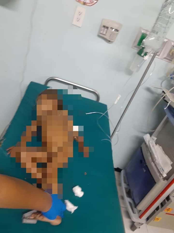 Tres personas heridas en tiroteo en Atlántida.