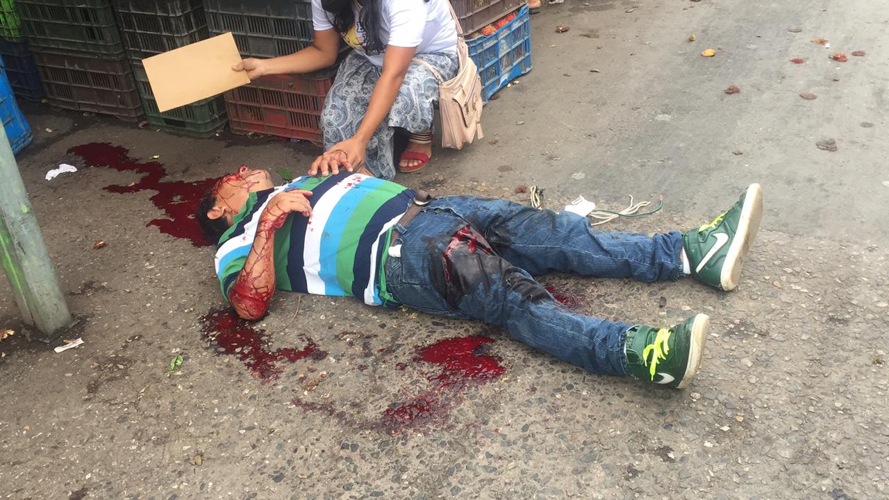 ¡Apuñalan a un carnicero!