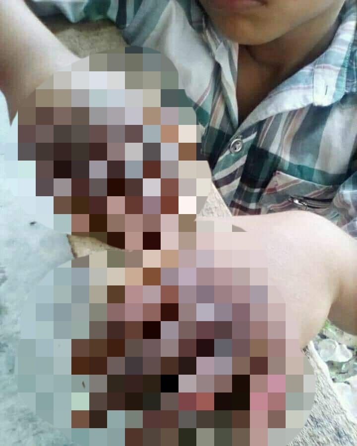 Madre le quema las manos a su hijo por tomar dinero ajeno.