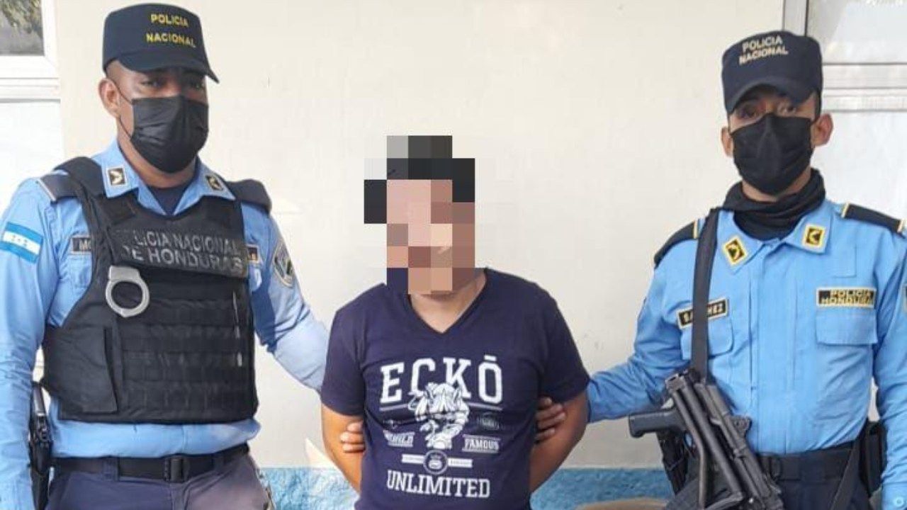 En libertad dejan a hombre que quemó las manos de su hija por no grabar vídeo íntimo